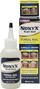 Nonyx Nail Gel, 4.0 OZ (2 Pack) 